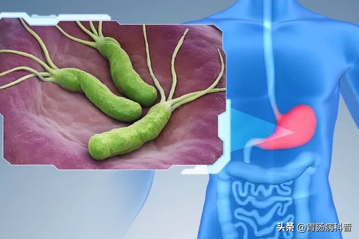 全球幽门螺杆菌的感染率大于50%,中国幽门螺旋杆菌感染防控白皮书