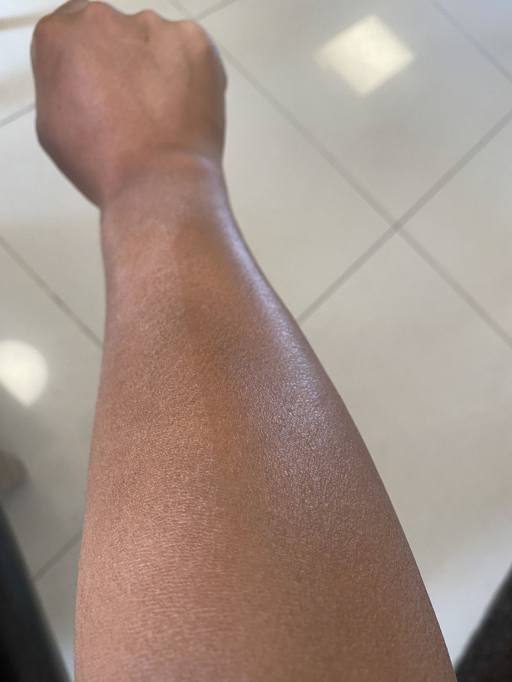 冬季皮肤干燥起皮有纹,皮肤干燥起蛇皮纹