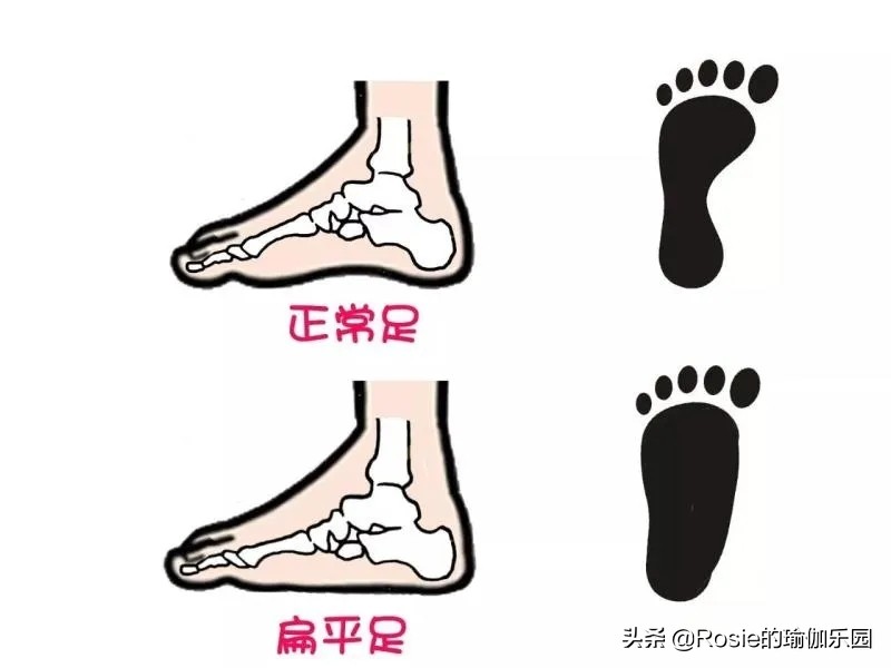 脚踝粗有办法瘦吗,脚踝很细大腿很粗怎么瘦