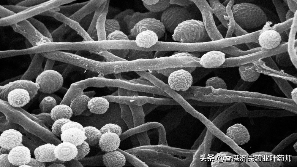 Ibrexafungerp预防复发性阴道酵母菌感染3期研究结果积极