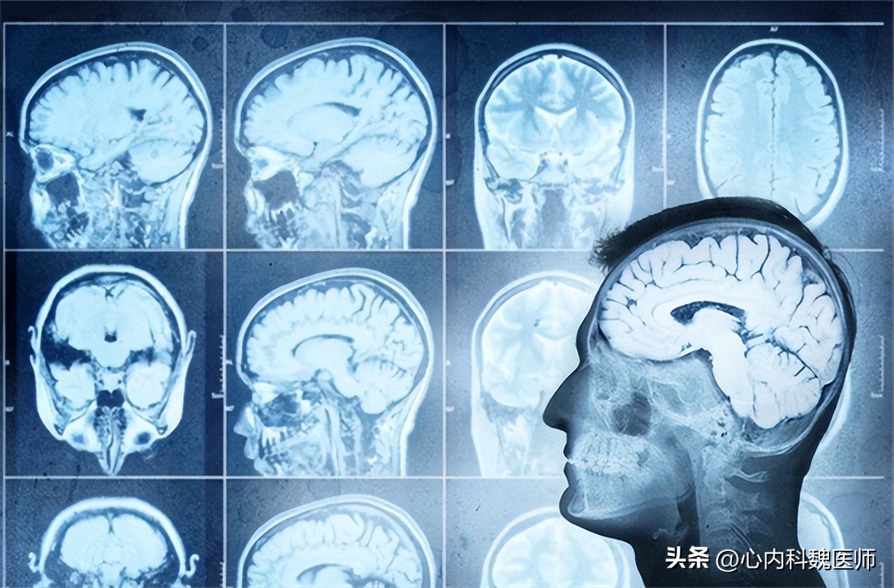 什么是磁共振检查的缺点,磁共振检查注意事项图片