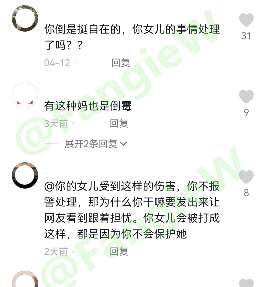 两岁女婴多次遭暴打后续,女孩被爷爷奶奶殴打后续