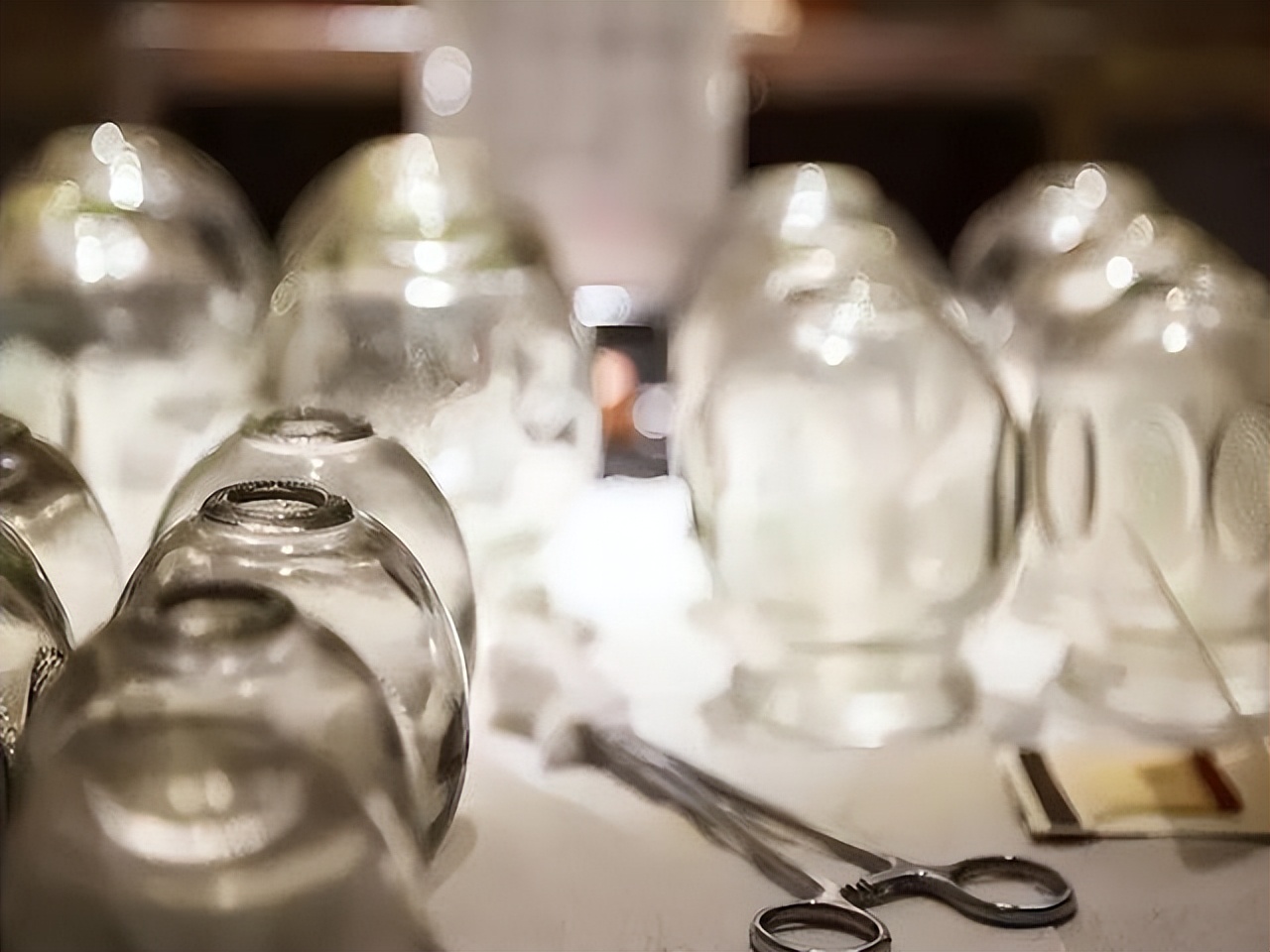 拔火罐时吸出来的淤血是毒素吗,拔火罐吸出来的瘀血是体内毒素