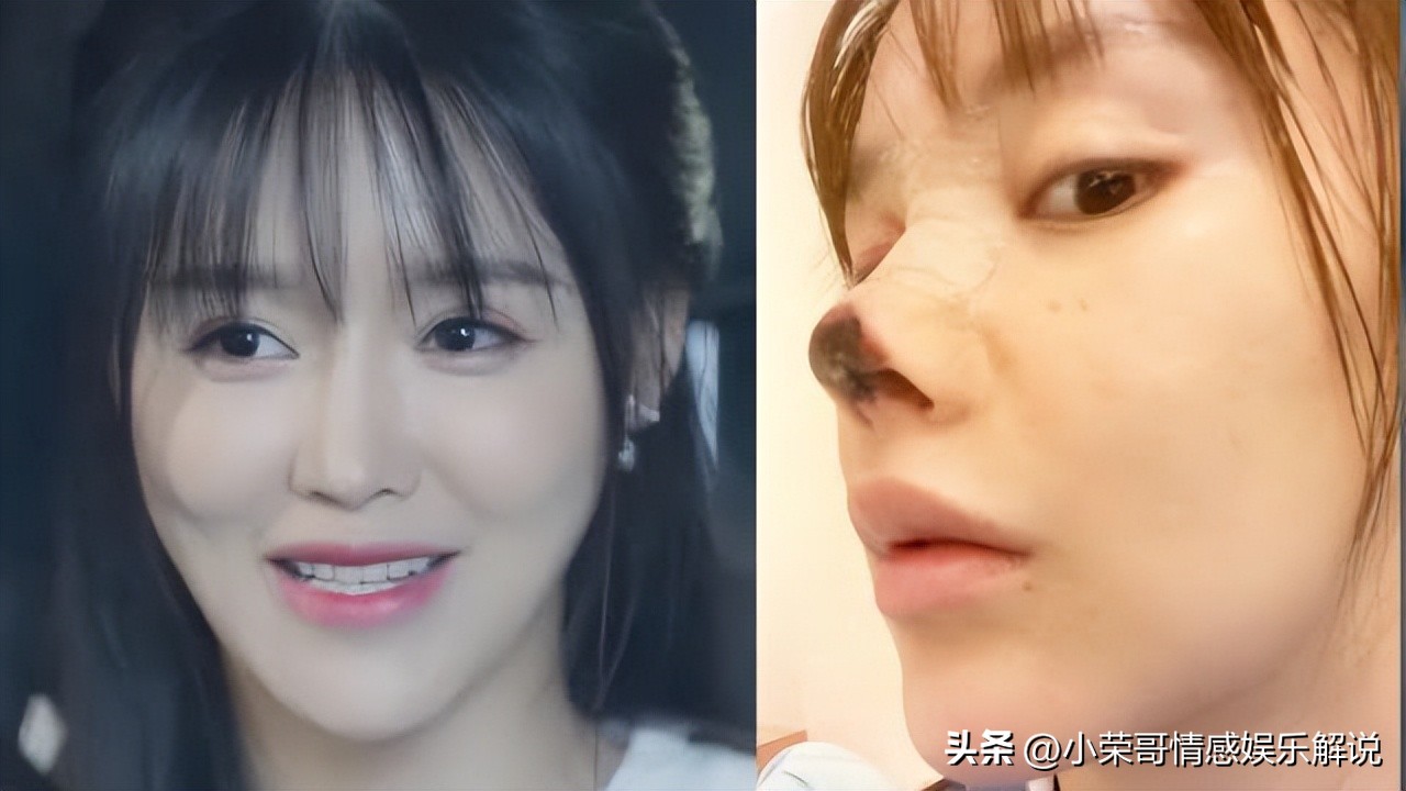整容失败最惨的案例女明星,整容失败的女明星为啥不再整回来