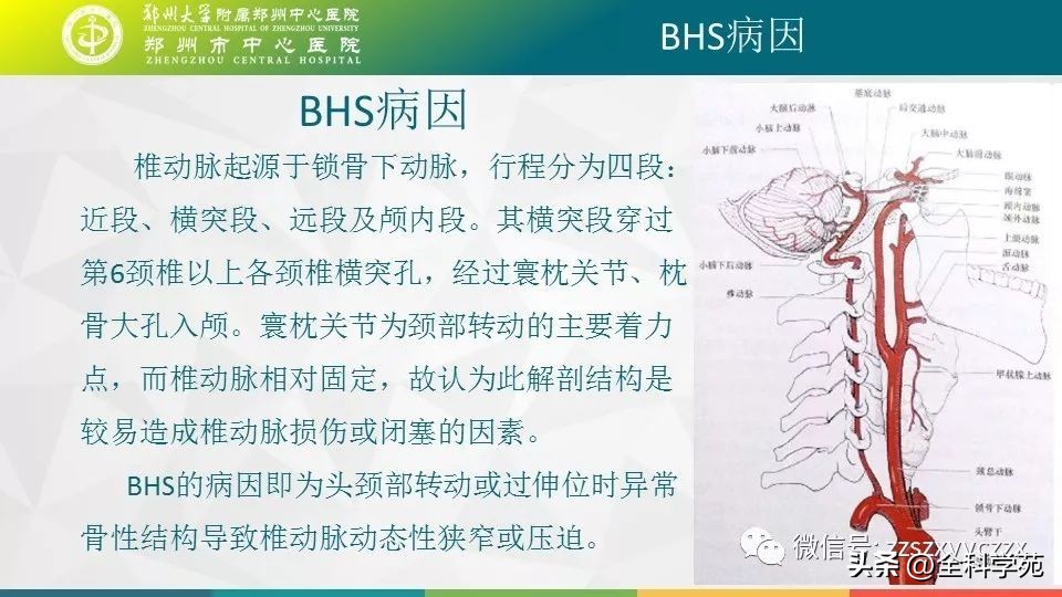 条件反射性眩晕,一种莫名的眩晕