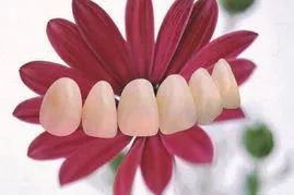 国产氧化锆烤瓷牙价格,二氧化锆烤瓷牙国产和爱尔创区别