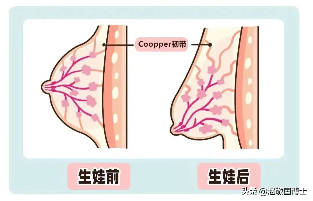 怎样预防面部下垂,如何预防胸下垂松弛