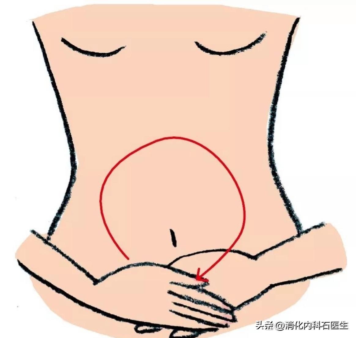 男性做了肠镜小腹隐痛,做完肠镜腹痛厉害怎么办