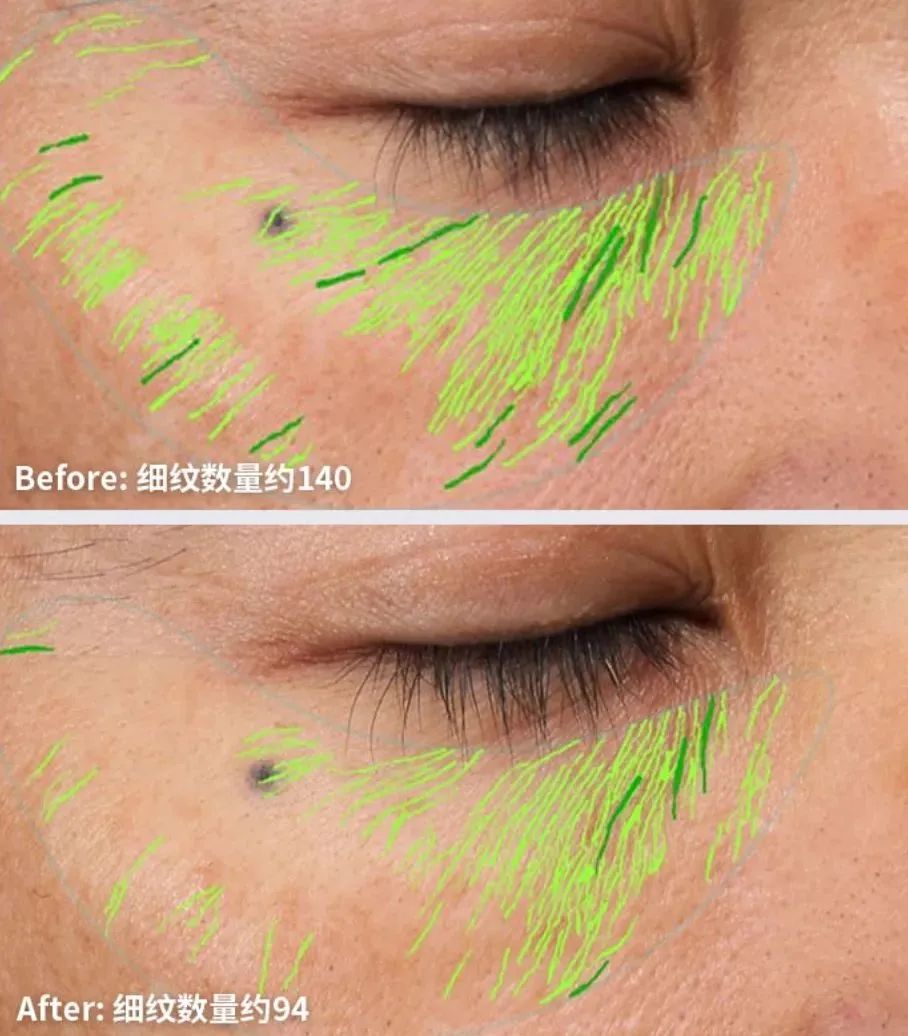 香港女明星冻龄,香港冻龄港姐吴婉芳