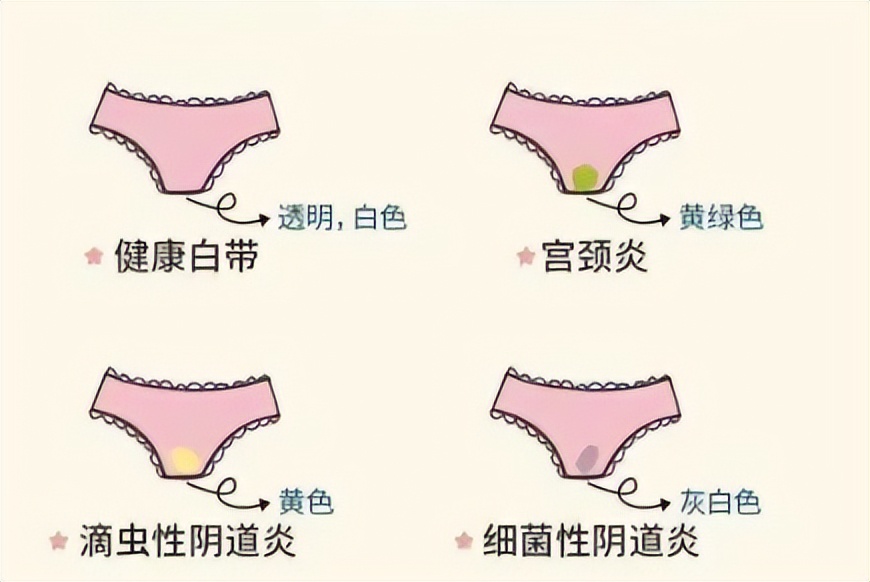 第一次月经来的最佳年龄是几岁,女孩子第一次月经什么年龄才正常