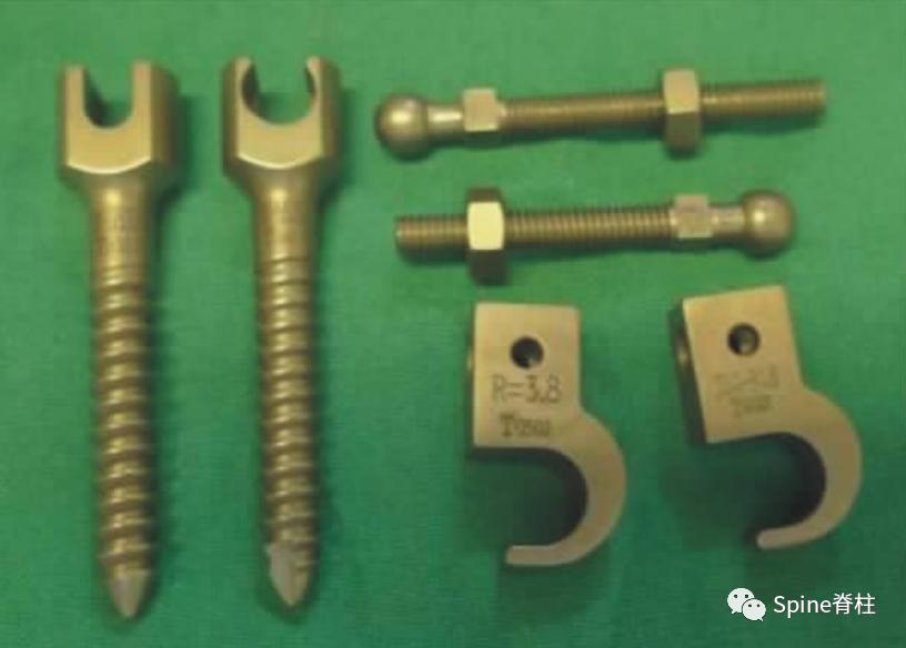 峡部裂和隐性峡部裂有区别吗,单纯峡部裂可以做峡部修复吗