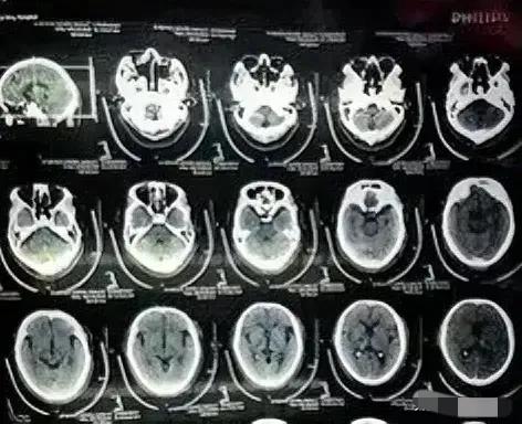 宿迁齐医生把“脸面看成比人命重要”坑害患者，被调查