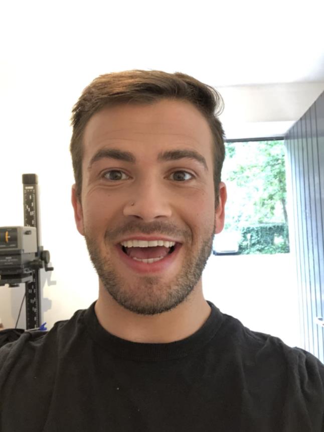 美国一位男子得了罕见的病,美国男子患罕见病症