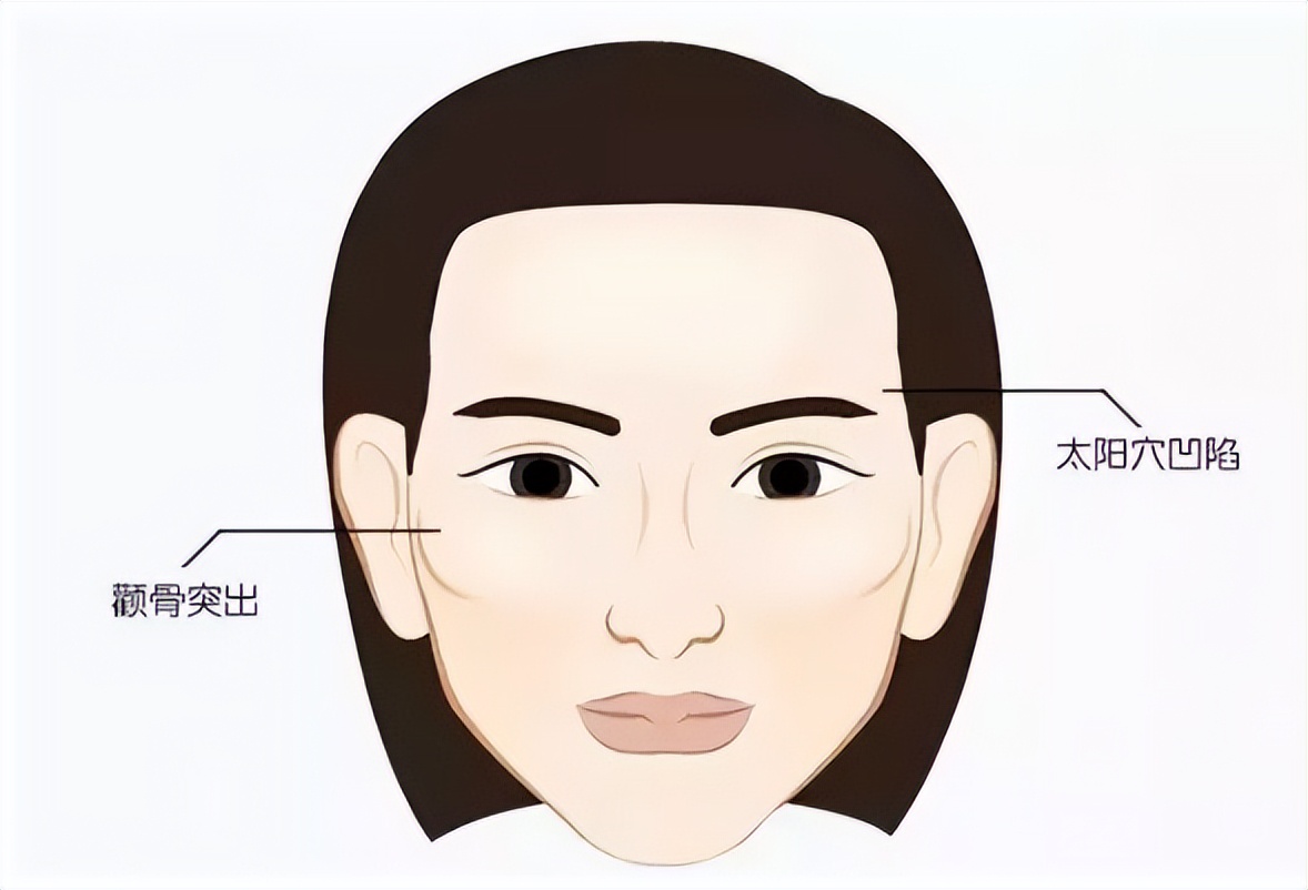 江苏苏王整形怎么样,苏王医疗整形做提眉怎么样