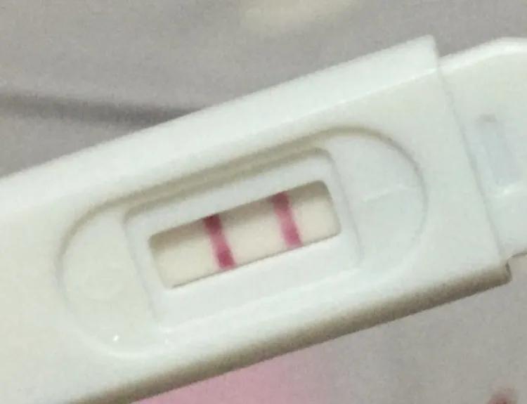 少女腹痛恶心一月，家长以为是怀孕，来医详查后发现问题很严重