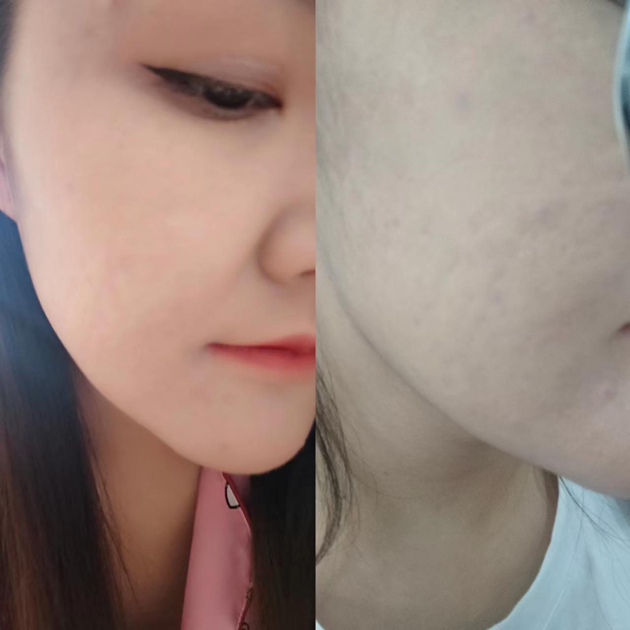 雅诗兰黛dw粉底液适合什么皮肤,粉底液夏天推荐平价遮瑕持妆