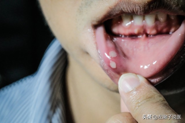 高血压人可以一直吃维生素b2吗,维生素b2对高血压有辅助作用