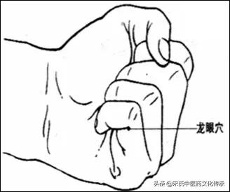 带状疱疹病例中医诊断,中医刺血预防带状疱疹