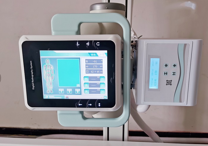 三维子宫输卵管超声造影临床应用,输卵管造影dr检查有辐射吗