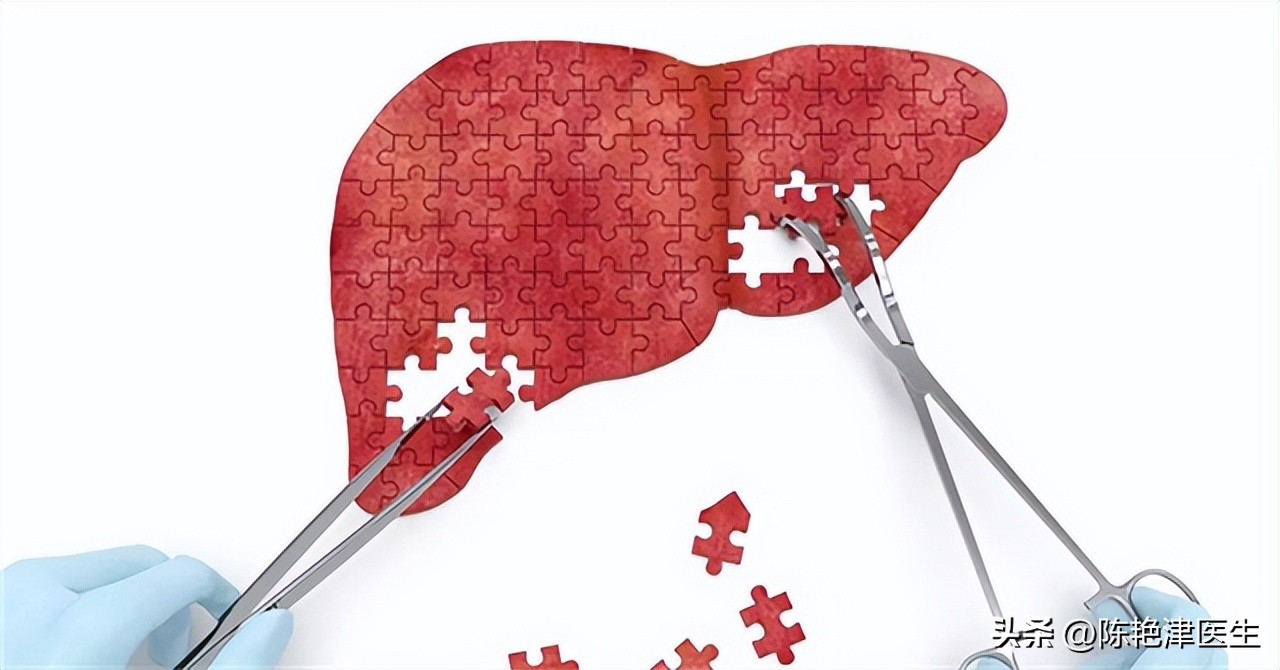 血脂高多少需要吃降脂药,血脂多高需要服用降脂药