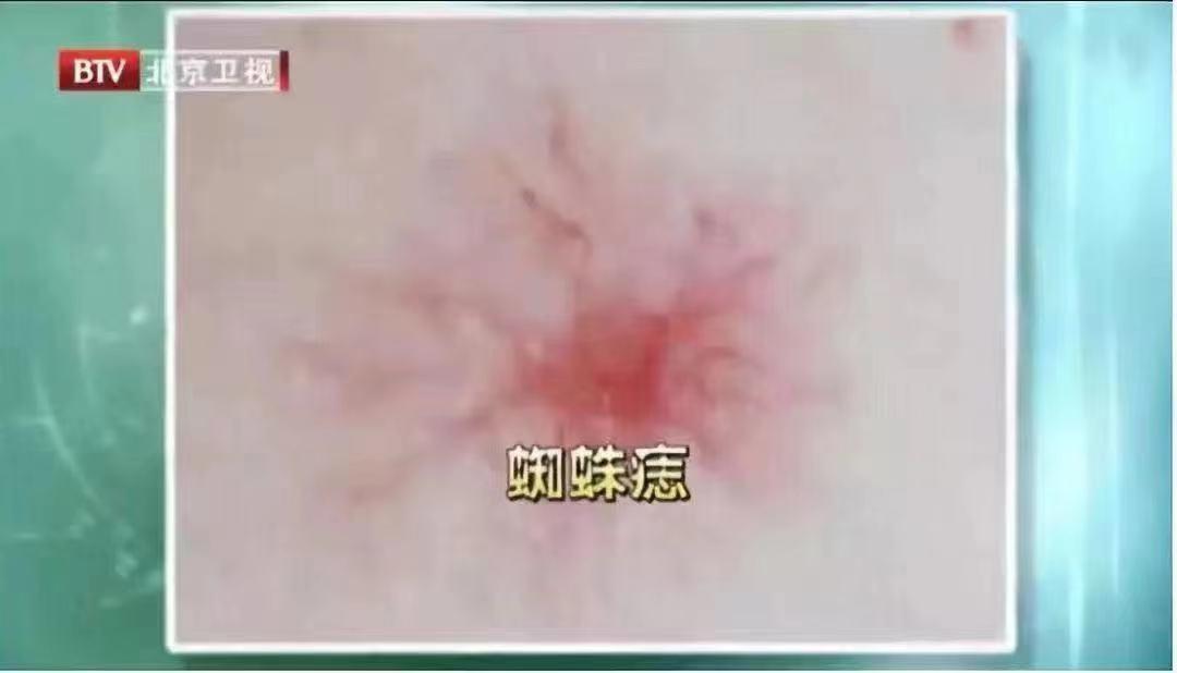 人体最脆弱的6个部位，伤到哪个都有致命的风险