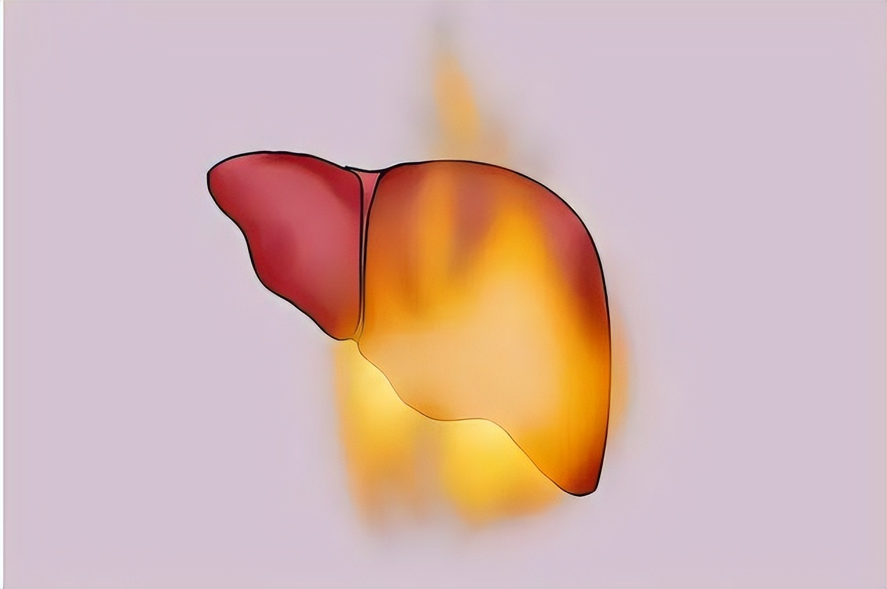 肝阴虚会有什么症状中医辨证,肝血虚与肝阴虚具体症状