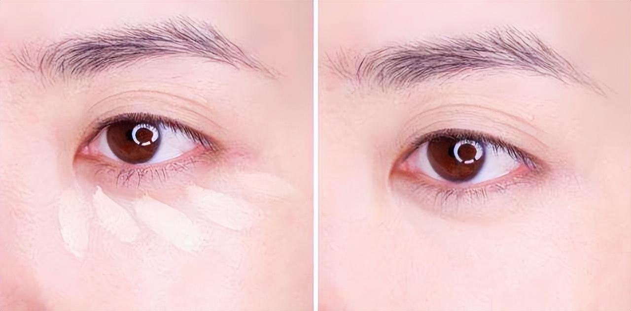 凸起的黑痘痘怎么遮瑕,痘痘瑕疵皮遮瑕