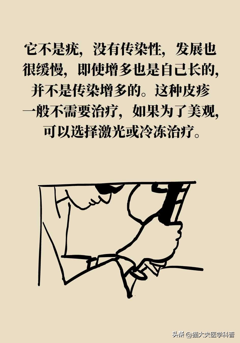 脖子上长的小肉揪怎么治啊,疣丝是不是脖子上的小肉粒