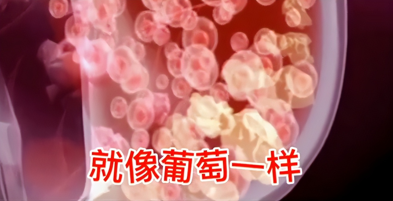 女子胸部锻炼出乳腺炎,女子保养胸部