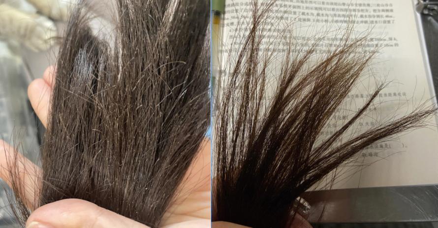 产后防脱发的洗发水有哪些,产后防脱发洗发水真实有效