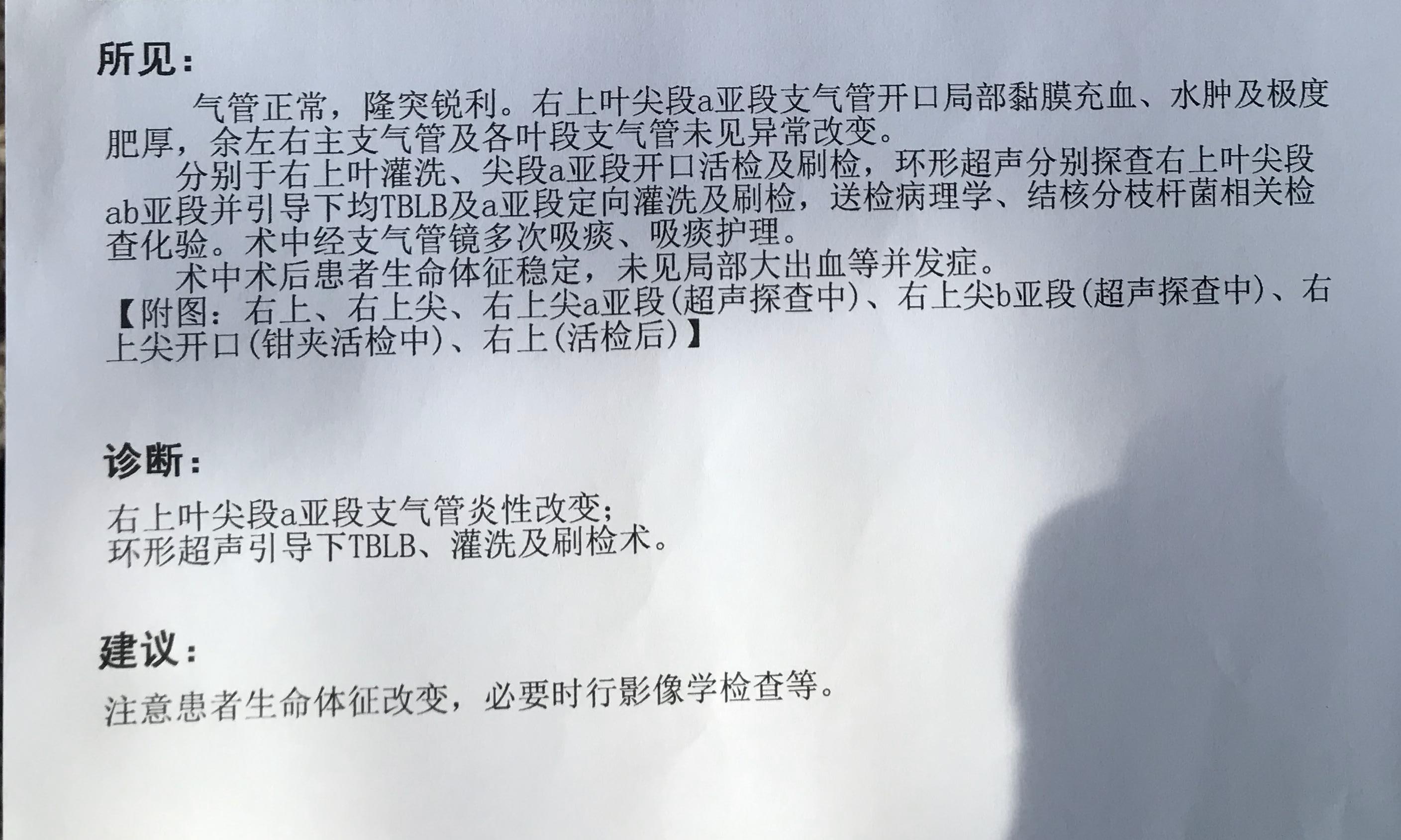 2天跑三家医院被拒收，幸好主任从胸片中看出端倪，救我一命