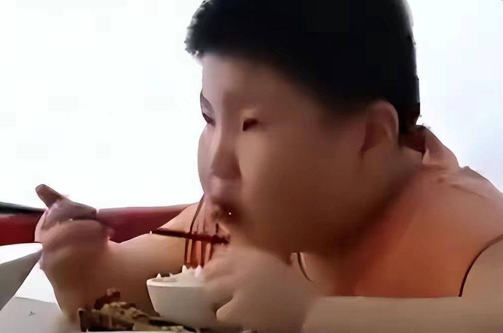 江西一男孩14岁达到300斤,10岁男孩一顿吃三碗体重飙到130斤