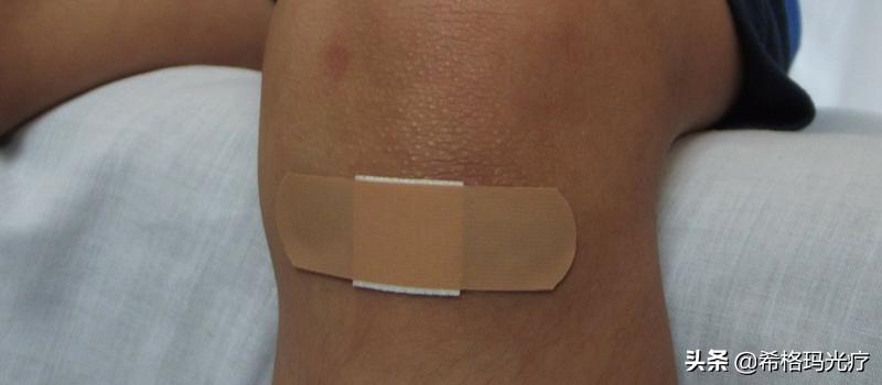 白癜风患处的皮肤发痒是什么原因,白癜风患处发痒是啥原因