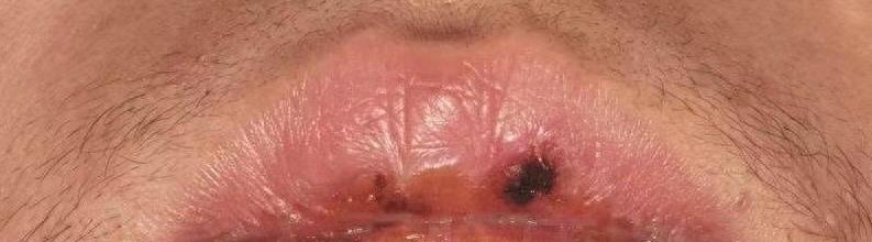 烈日下，女子下跪多日求复婚被拒，前夫发声，知情人透露实情