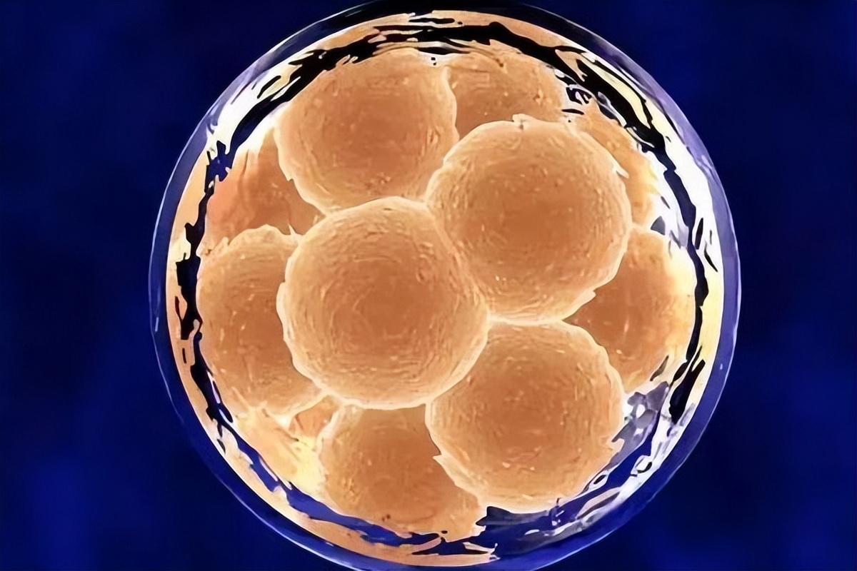 血清hcg和血液hcg区别,什么是血hcg检查什么