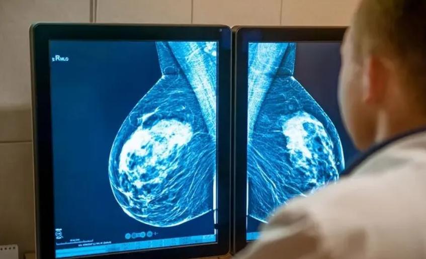 乳腺结节，多因脾肾两虚！一张方子调补脾肾、化痰散结，巧化解