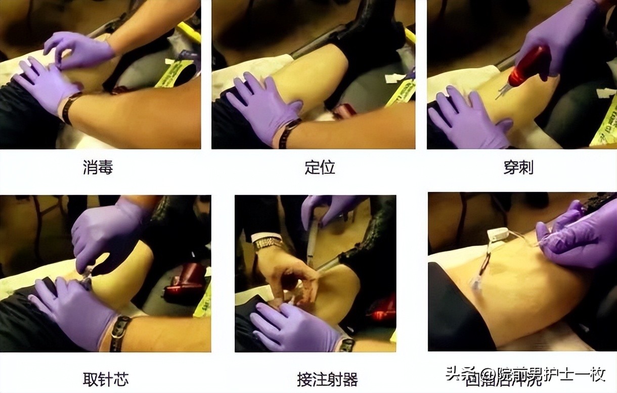 骨髓腔穿刺急救,骨髓腔穿刺适应症和禁忌症