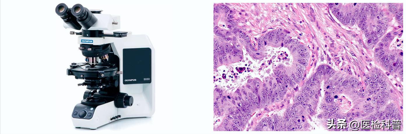 医院失误导致女子胸部被切除,女子被误诊切除子宫