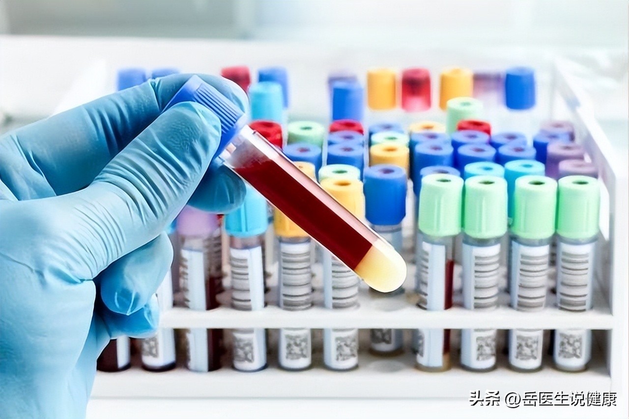 阿托伐他汀改为瑞舒伐有什么好处,阿托伐他汀为何改服瑞舒伐他汀