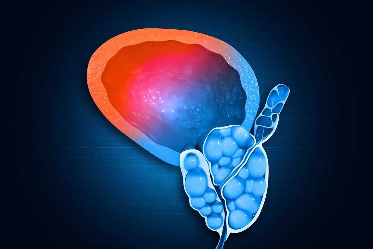 有些女性下身无毛是怎么回事？这4个原因，为了健康最好了解一下