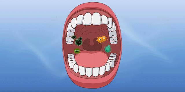 牙医遇到有口臭的病人怎么办,牙医推荐去黄去口臭的牙膏