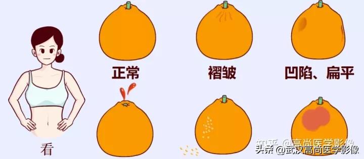 胸痛有硬块是肿瘤吗,胸部结节疼痛是乳腺癌吗