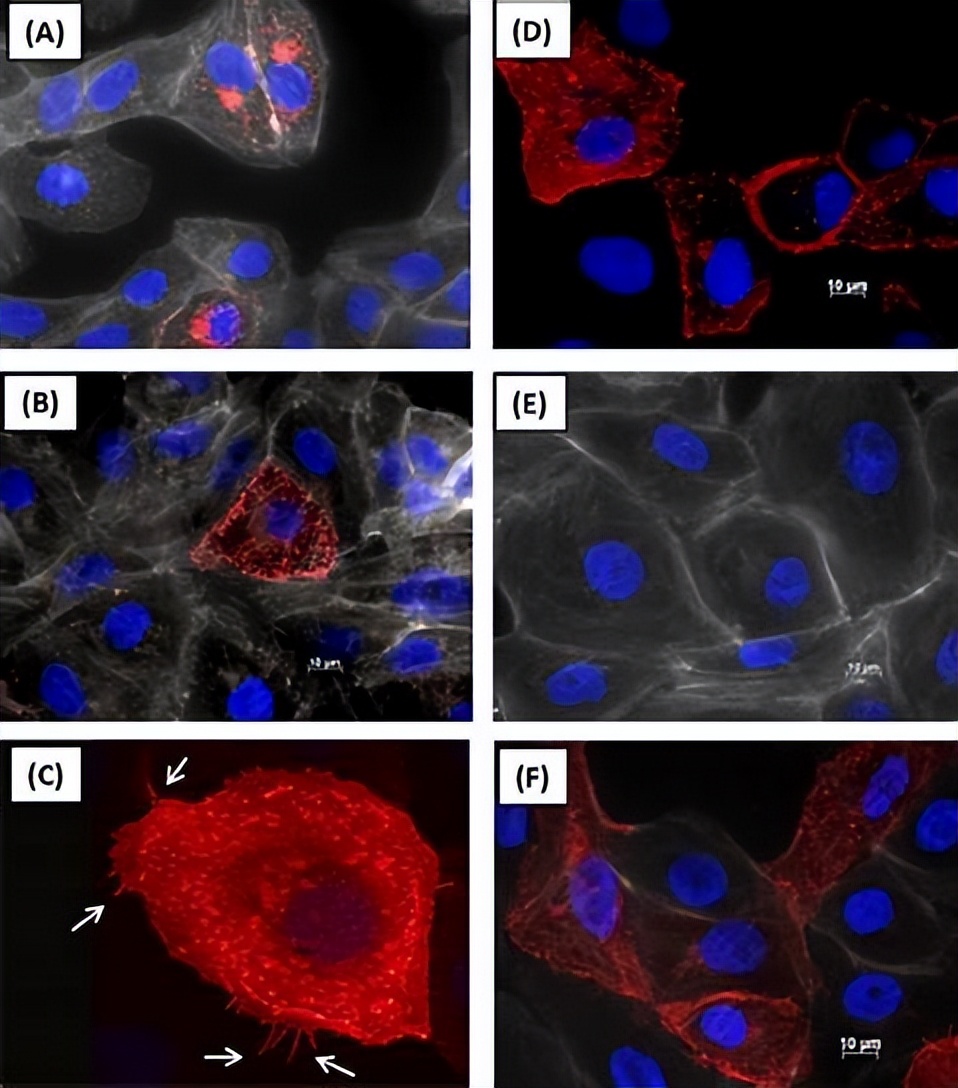 嵌合犬瘟热病毒Ｈ基因的重组狂犬病病毒的构建及免疫原性研究