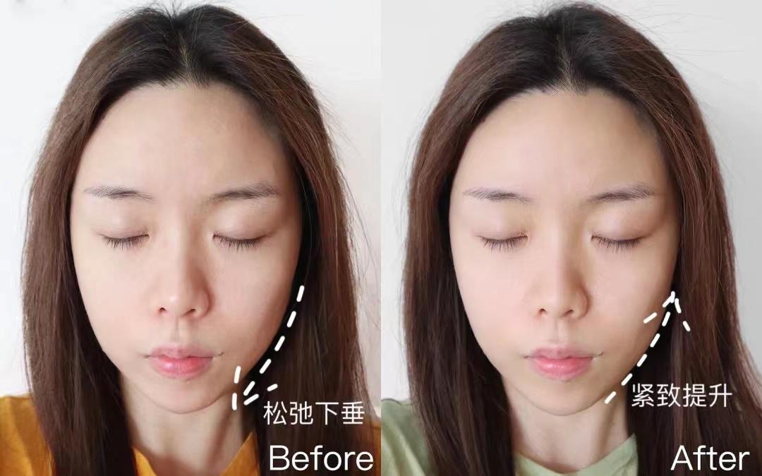 国货大战欧莱雅玻色因,欧莱雅和玻色因哪个好