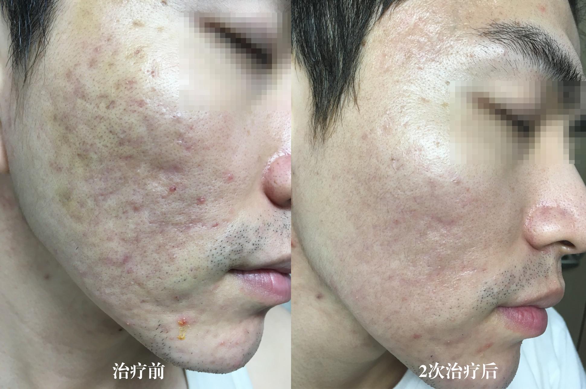 32岁相亲被拒36次,32岁相亲遭嫌弃