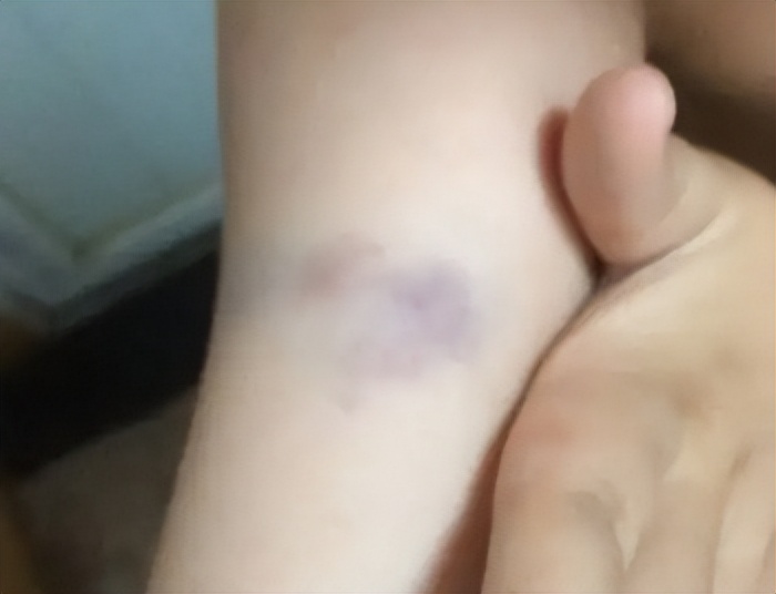 筋膜枪大力度推荐测评,2023专业级筋膜枪测评排行榜