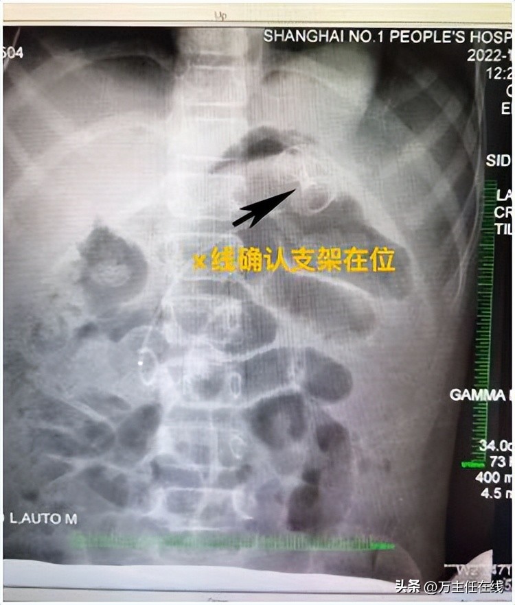 上海市儿童医学中心消化科,上海第一人民医院消化科万荣教授