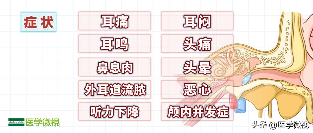 脑袋嗡嗡响耳朵有点聋,耳朵嗡嗡响的预兆
