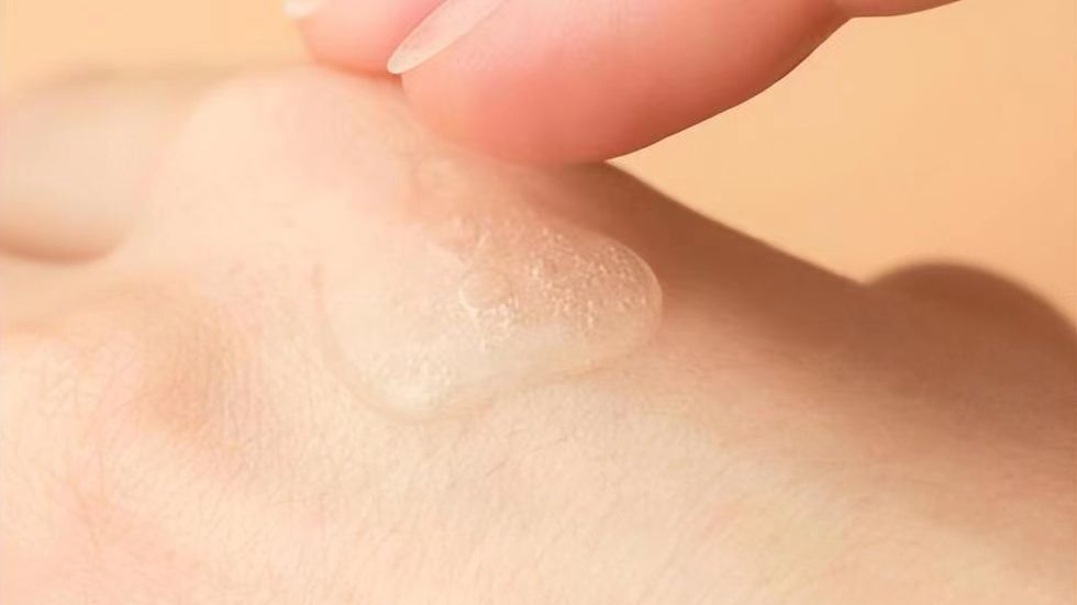 女性*处私**的润滑液是如何产生的?如何改善*处私**干燥?医生告诉你