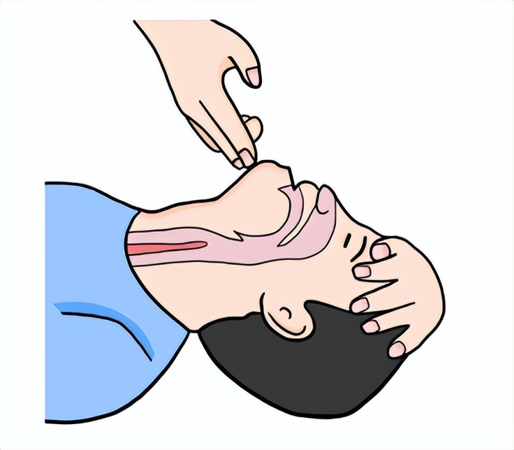 心肌梗死最佳急救时间,心肌梗死急救的穴位